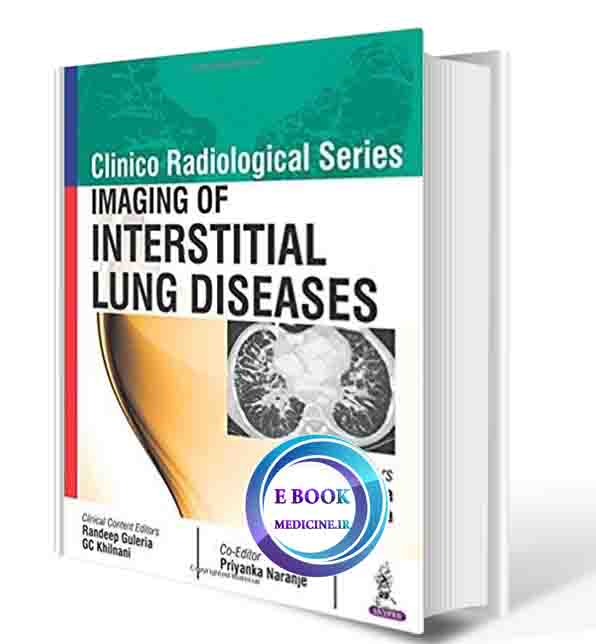 دانلود کتاب Imaging of Interstitial Lung Diseases (Clinico Radiological) 2017(ORIGINAL PDF)